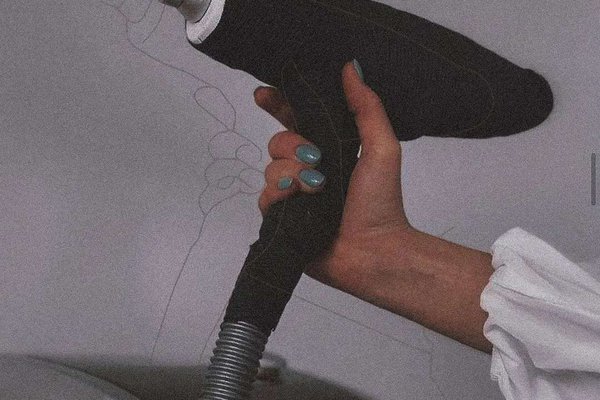 Tatouage Entfernung in Berlin