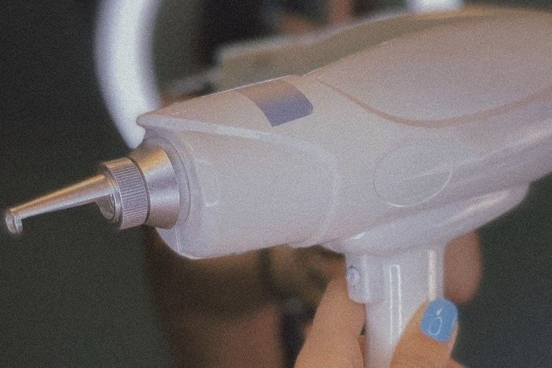 Tatouage Entfernung in Berlin