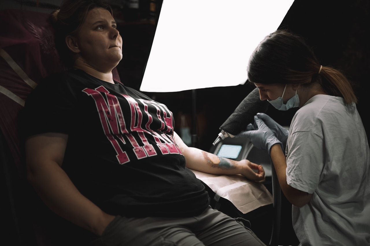 Tattoo Entfernen in Nürnberg