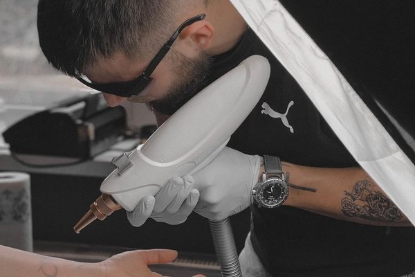 Laser tattoo removal in Frankfurt