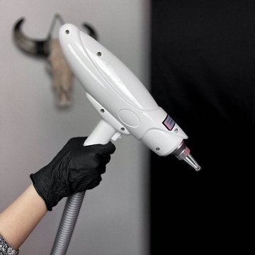 Laser PMU Removal in Frankfurt