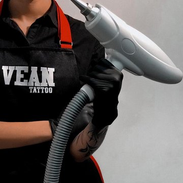 Laser PMU Removal in Frankfurt
