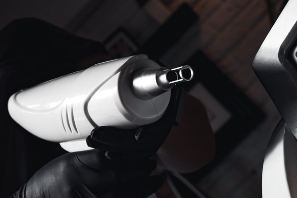 Permanent Make-up Entfernen Laser in Nürnberg