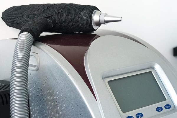 Tattooentfernung in Frankfurt am Main