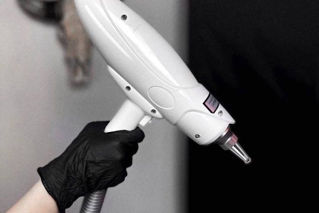 Tattooentfernung in Frankfurt am Main