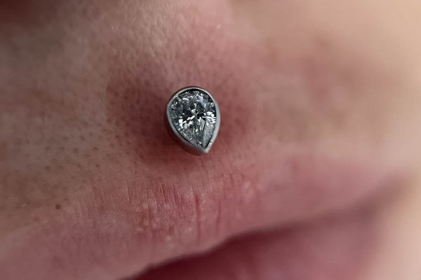 medusa piercing heilungsdauer