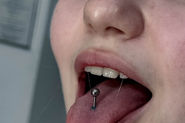 Zungen piercing
