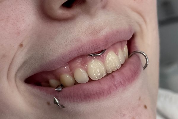 Piercing Smiley
