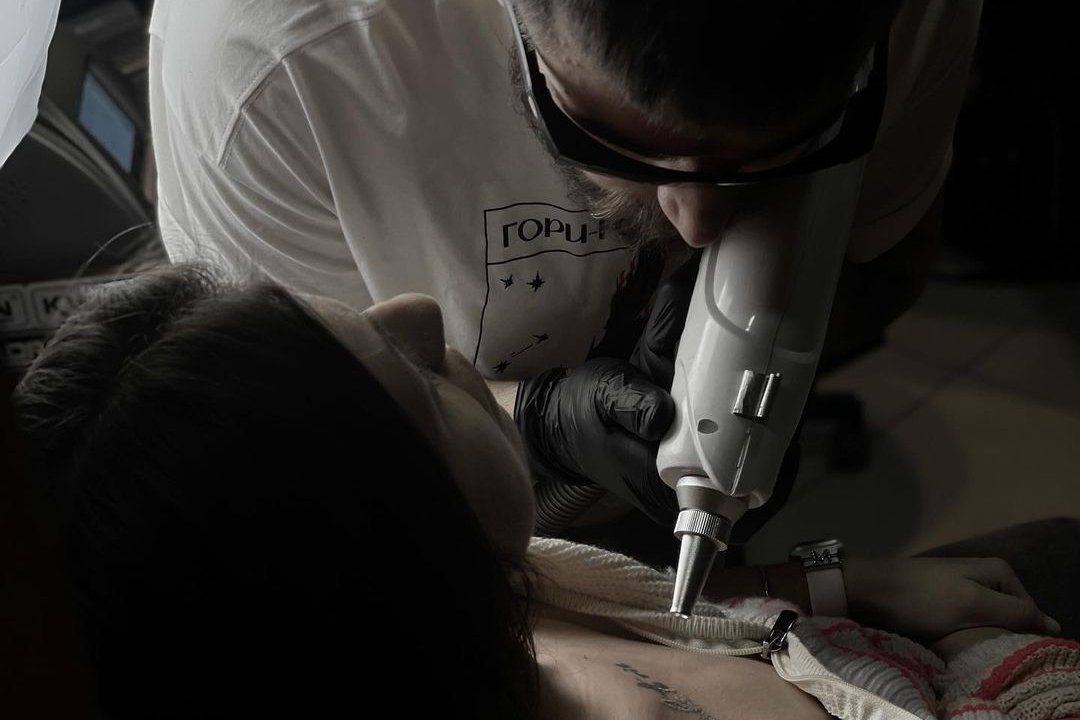 Tattooentfernung in Gotha
