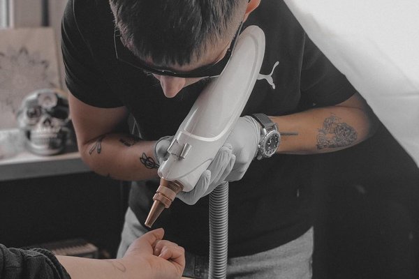 Tattooentfernung in Gotha